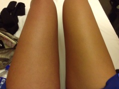 My left leg was swollen, darker and in excruciating pain.